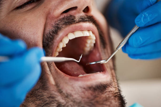Best Emergency Dental Care for Broken or Chipped Teeth in Green Tree, PA